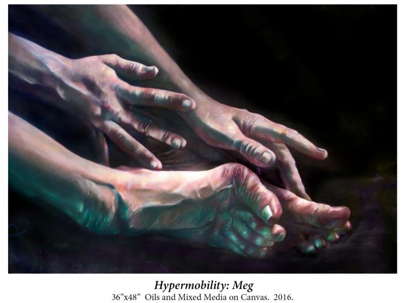 Hypermobility: Meg (by MANDEM)