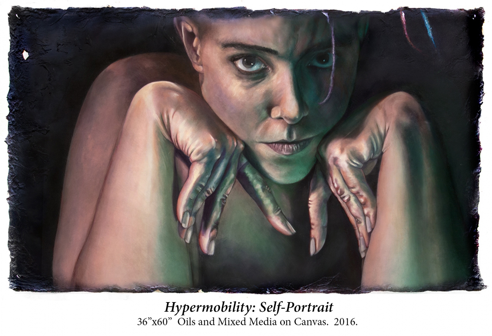 Hypermobility: Self-Portrait (by MANDEM)