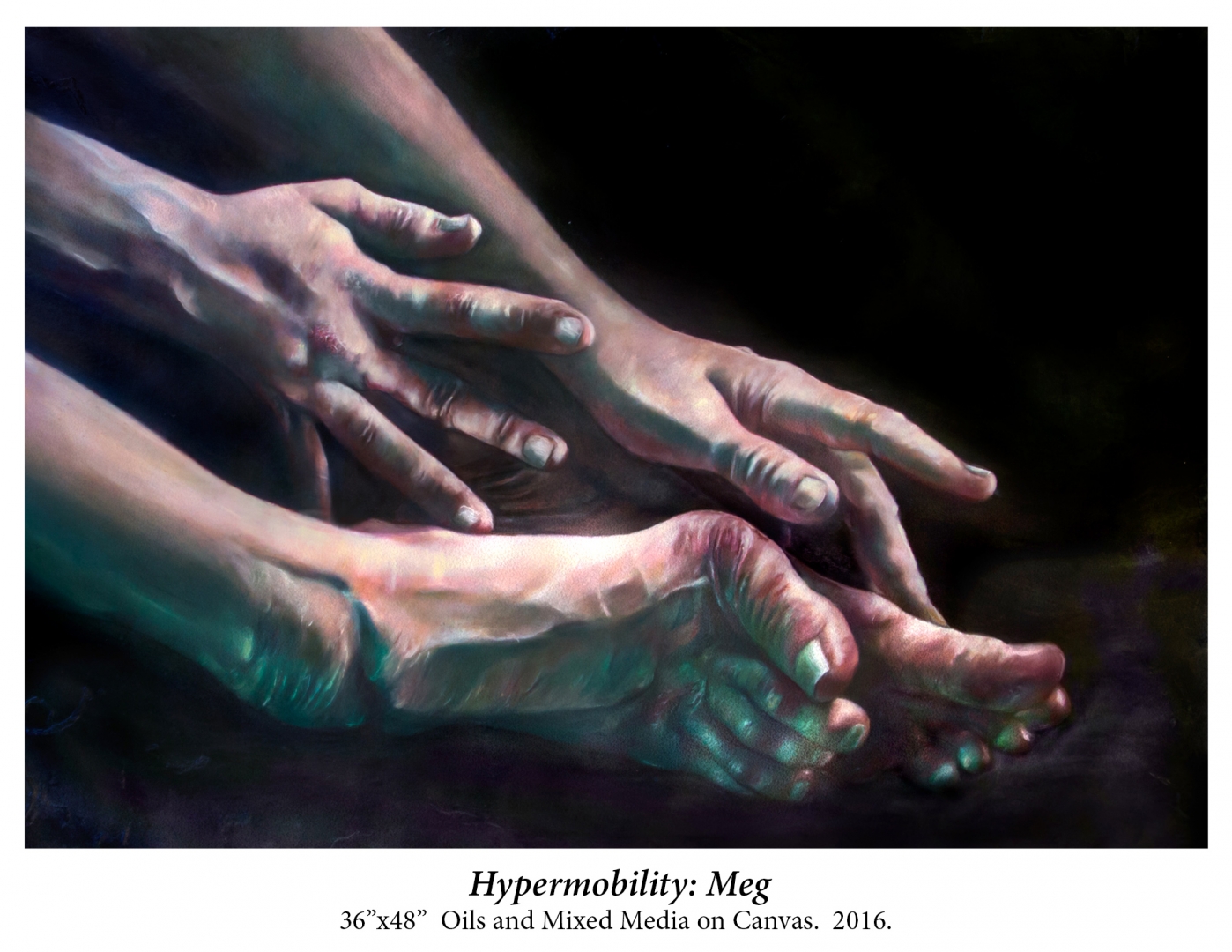 Hypermobility: Meg (by MANDEM)